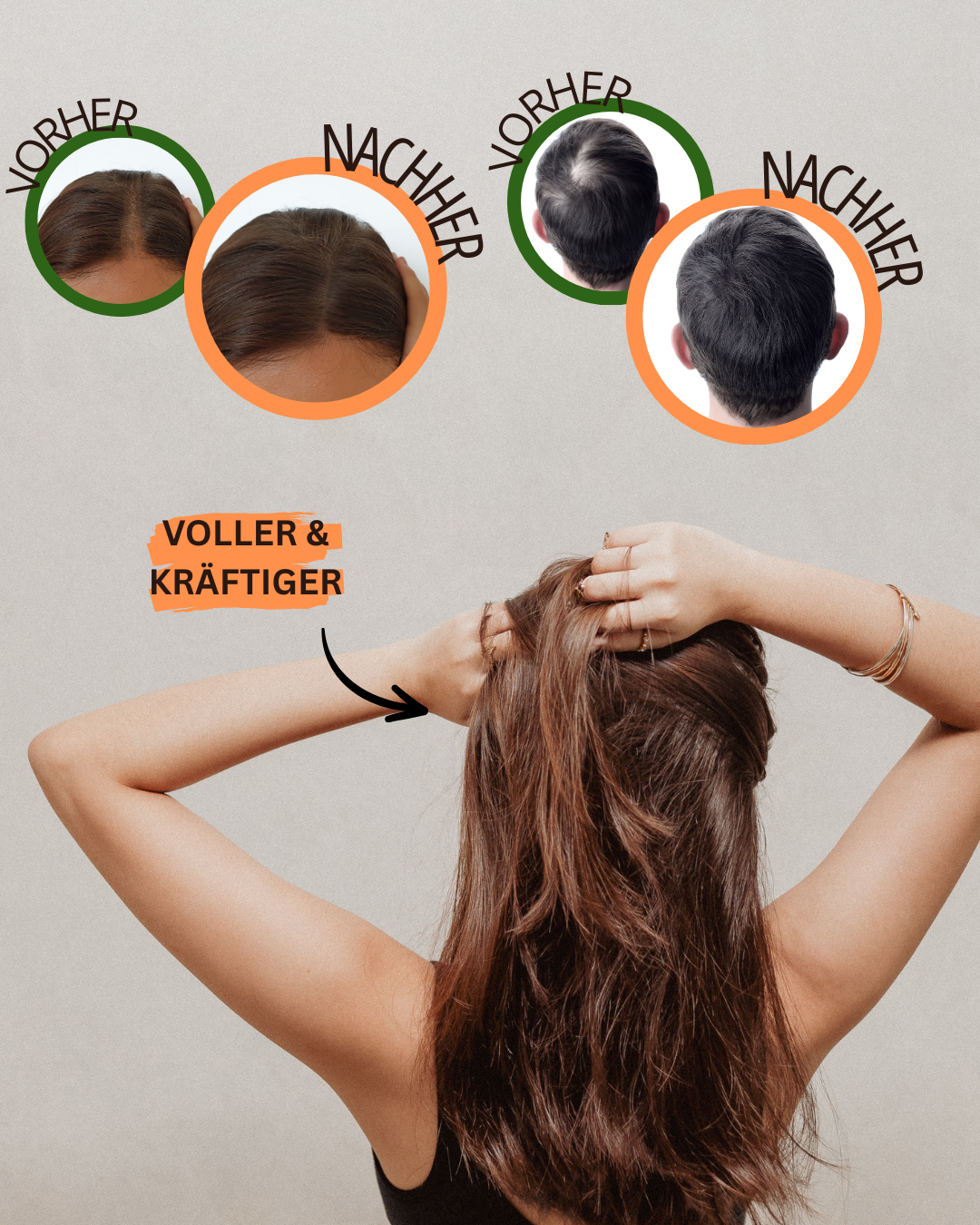 Hair Growth Power Bundle - 2 Sprays + 1 Scalp Massager