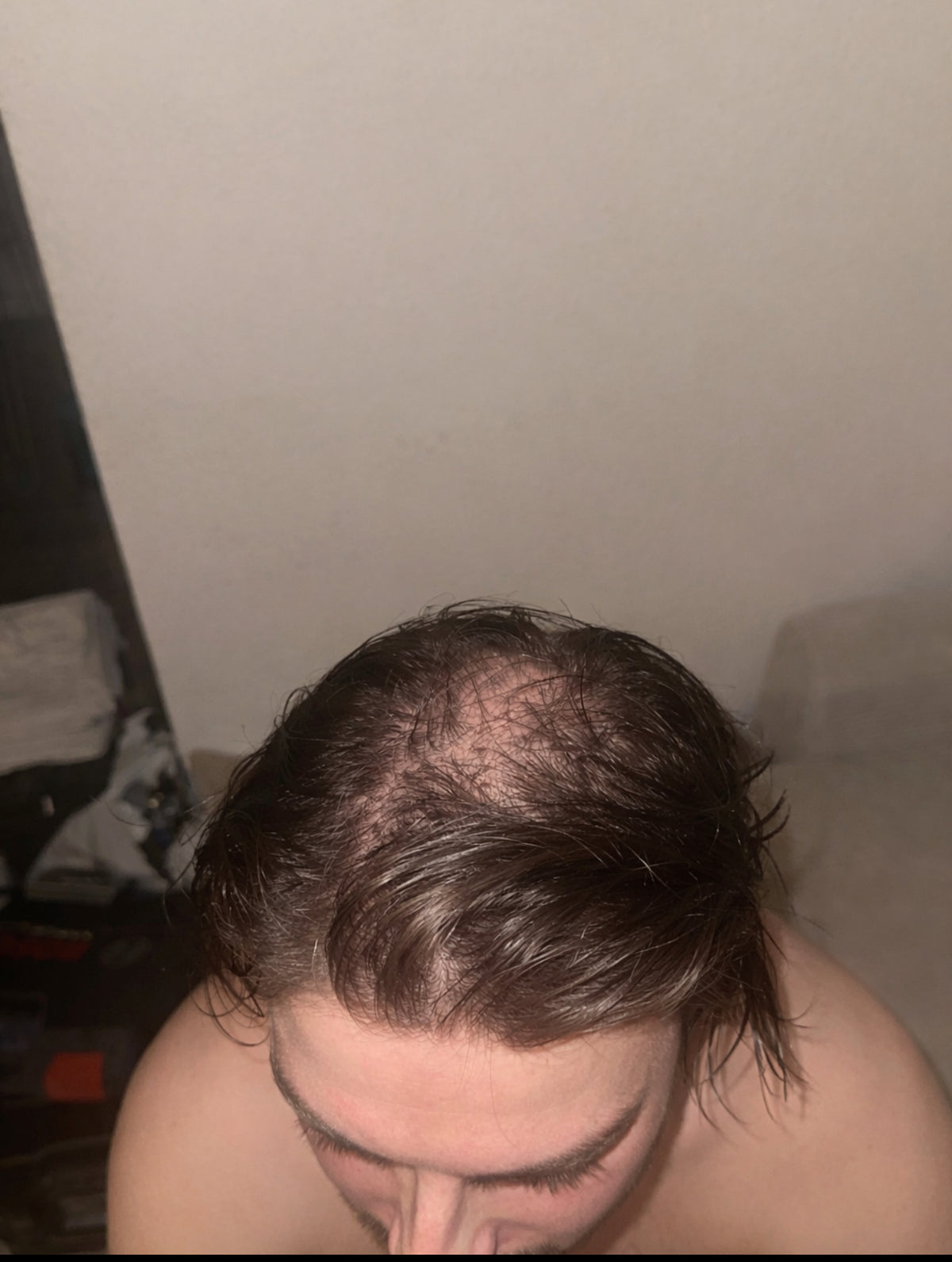 Before Transformation